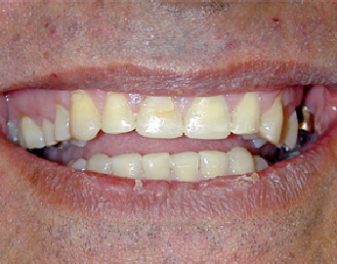 After - Lenham Dental