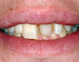 Before - Lenham Dental