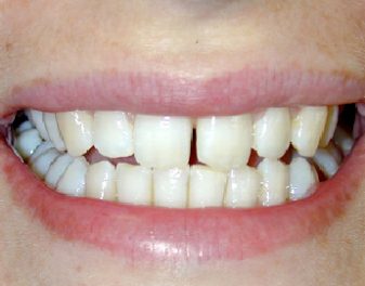 Before - Lenham Dental