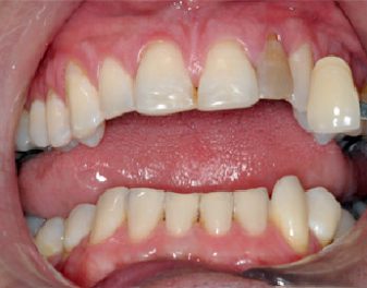 Before - Lenham Dental